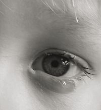 Rhinoscopy assisted lacrimal probing – minimal invasive and effective therapeutic option for children with congenital nasolacrimal duct obstruction