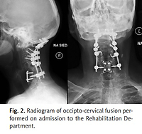 Prophylaxis of occipital pressure sores in patients after elective spinal surgery in a pandemic condition