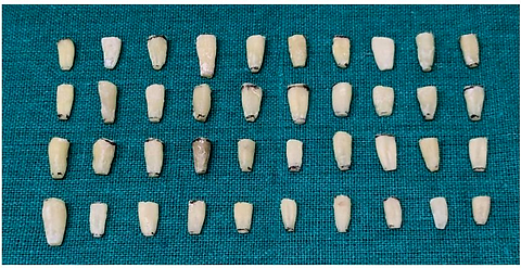 Evaluation of the effect of pre-treatment of intra-radicular dentin with various agents on bio-dentine’s sealing ability in immature roots: an ex vivo study