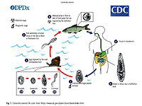 The role of liver fluke invasion in the pathogenesis of cholangiocarcinoma