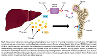 Osteoporosis in primary biliary cholangitis: from cholestasis to fracture prevention