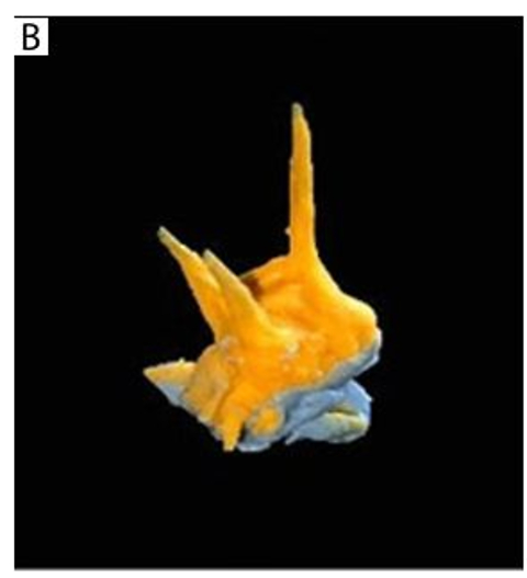 Comparative assessment of efficacy of automated micromotor and endomotor in biomechanical preparation of primary and permanent teeth: an in vitro pilot study