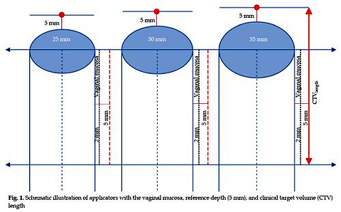Comparative dosimetric study of single- vs. multi-channel cylindrical applicators in vaginal brachytherapy: Implications for organs at risk and vaginal surface doses