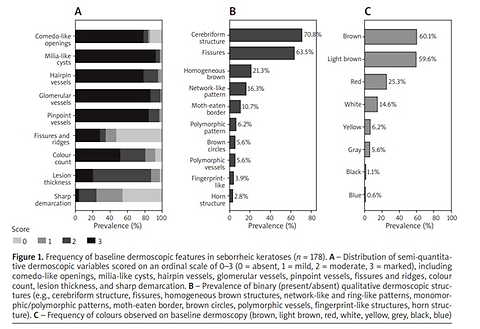 20-MHz high-intensity focused ultrasound for seborrheic keratoses of the head and neck: outcomes and dermoscopic predictors