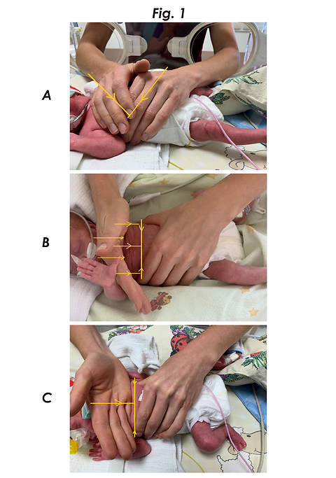 Application of expiratory flow increased technique in the respiratory therapy of premature neonates: a systematic review