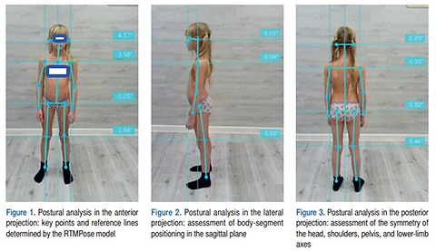 Application of artificial intelligence in screening postural assessment of children and adolescents: implications for medical and nursing practice