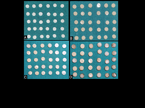 Comparative evaluation of color stability of monoshade and multishade composite resin: An in vitro study