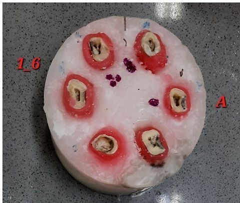 Comparative accuracy of two CBCT scanners with different fields of view for measurement of radicular dentin thickness of maxillary first molars