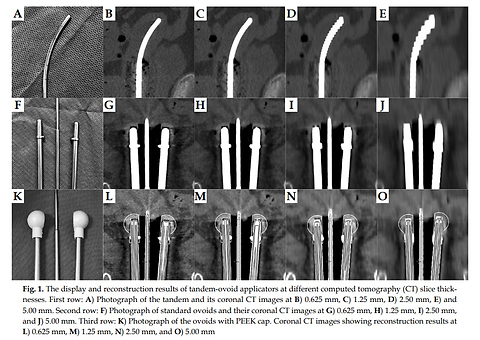 Dosimetric impact of computed tomography slice thickness-induced applicator reconstruction uncertainties in three-dimensional brachytherapy for cervical cancer