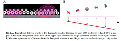 Comprehensive clinical dosimetry in contact skin interventional radiotherapy (modern brachytherapy): Practical tips and tricks