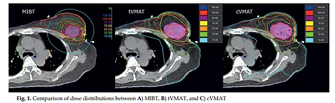 Dosimetric comparison of organs at risk exposure in multicatheter high-dose-rate interstitial brachytherapy vs. VMAT-based APBI for real patient treatment plans