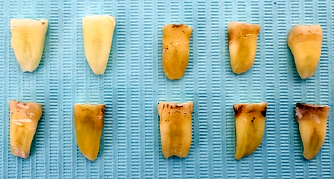 Evaluation of the amount of apical debris extrusion using new file systems in curved root canal treatments