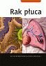 Rak płuca