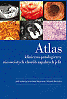 Atlas kliniczno-patologiczny nieswoistych chorób zapalnych jelit.
<br><br>