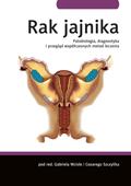 Rak jajnika - patobiologia, diagnostyka i przegląd współczesnych metod leczenia
