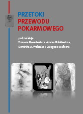 Przetoki przewodu pokarmowego