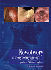Nowotwory w otorynolaryngologii. Wydanie II uaktualnione