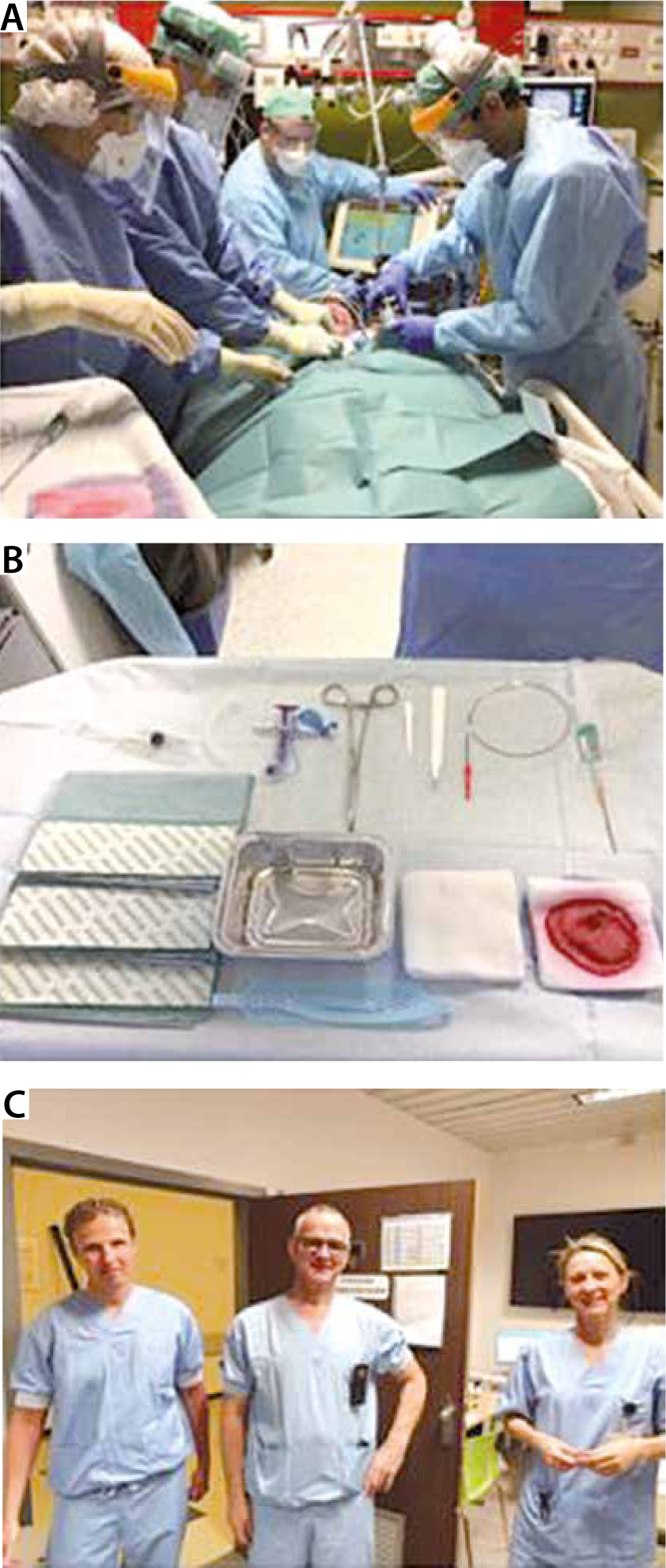 Percutaneous tracheostomy for longterm ventilated COVID19patients