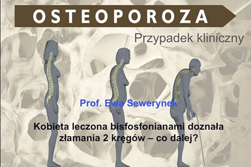 Osteoporoza - przypadek...