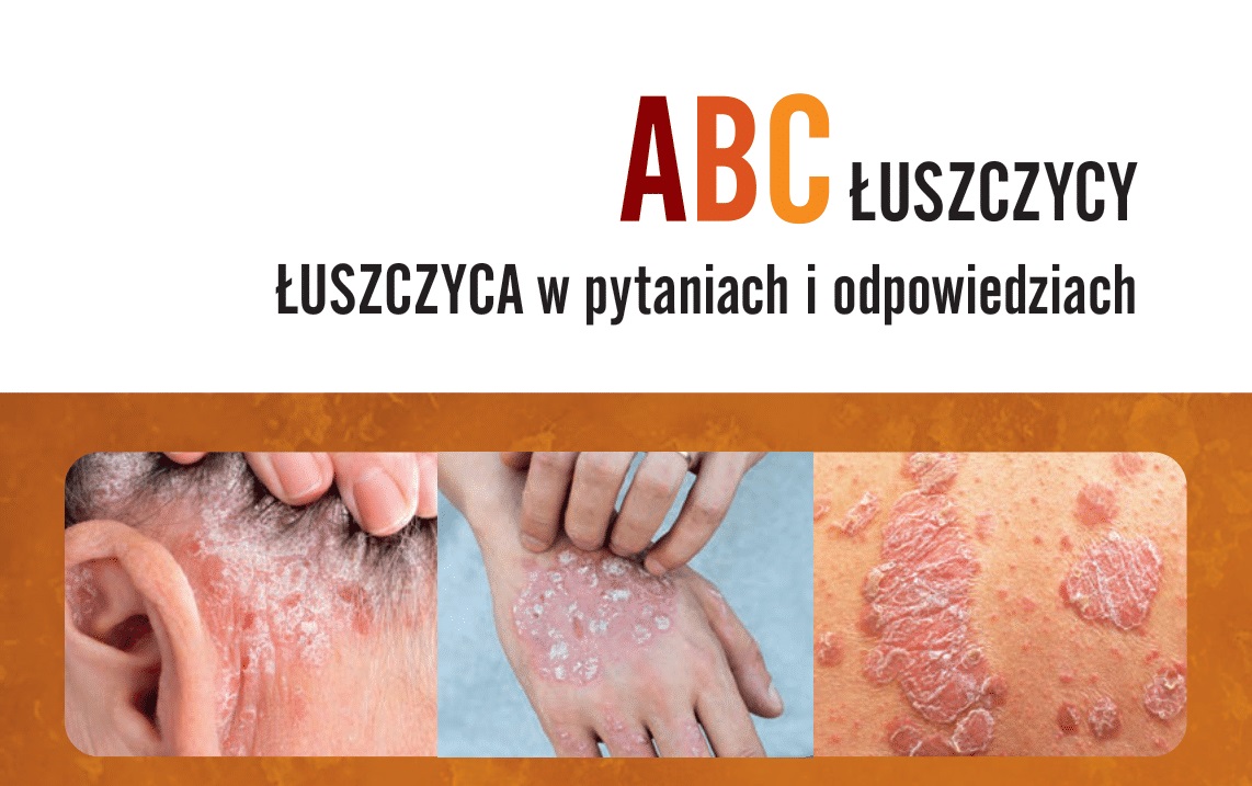 "ABC łuszczycy. Łuszczyca w pytaniach i odpowiedziach" – książka już dostępna w sprzedaży!