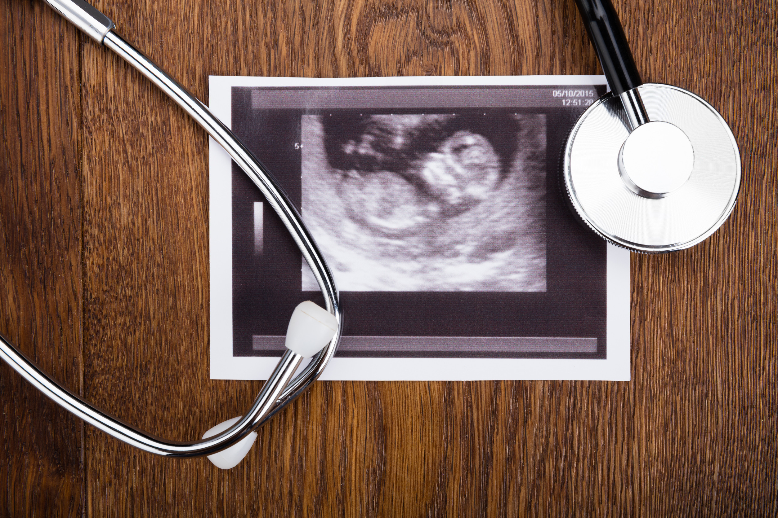 W woj. łódzkim od lipca więcej ośrodków zapewniających badania prenatalne na NFZ