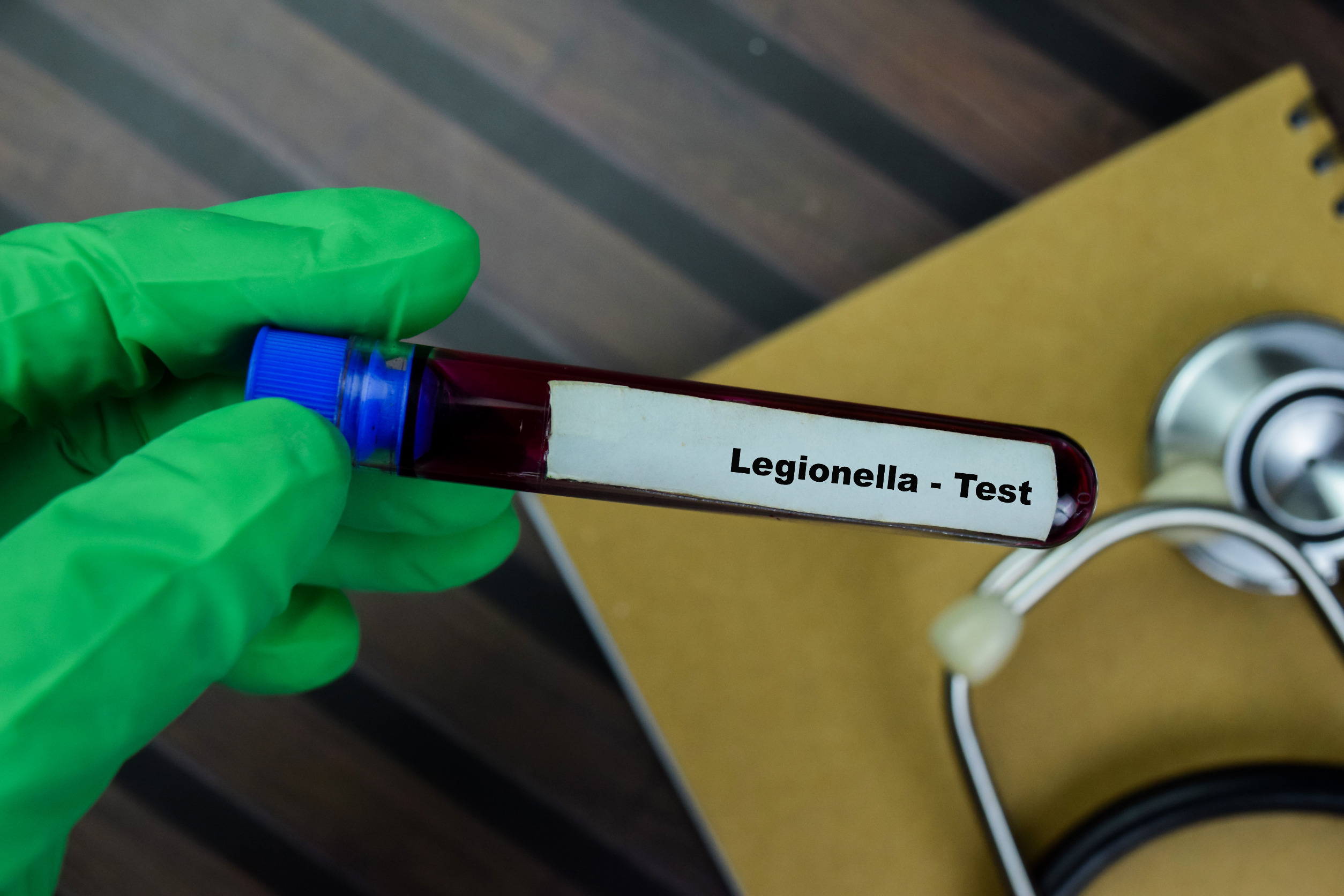 Zwiększa się liczba zakażonych Legionella pneumophila w woj. podkarpackim
