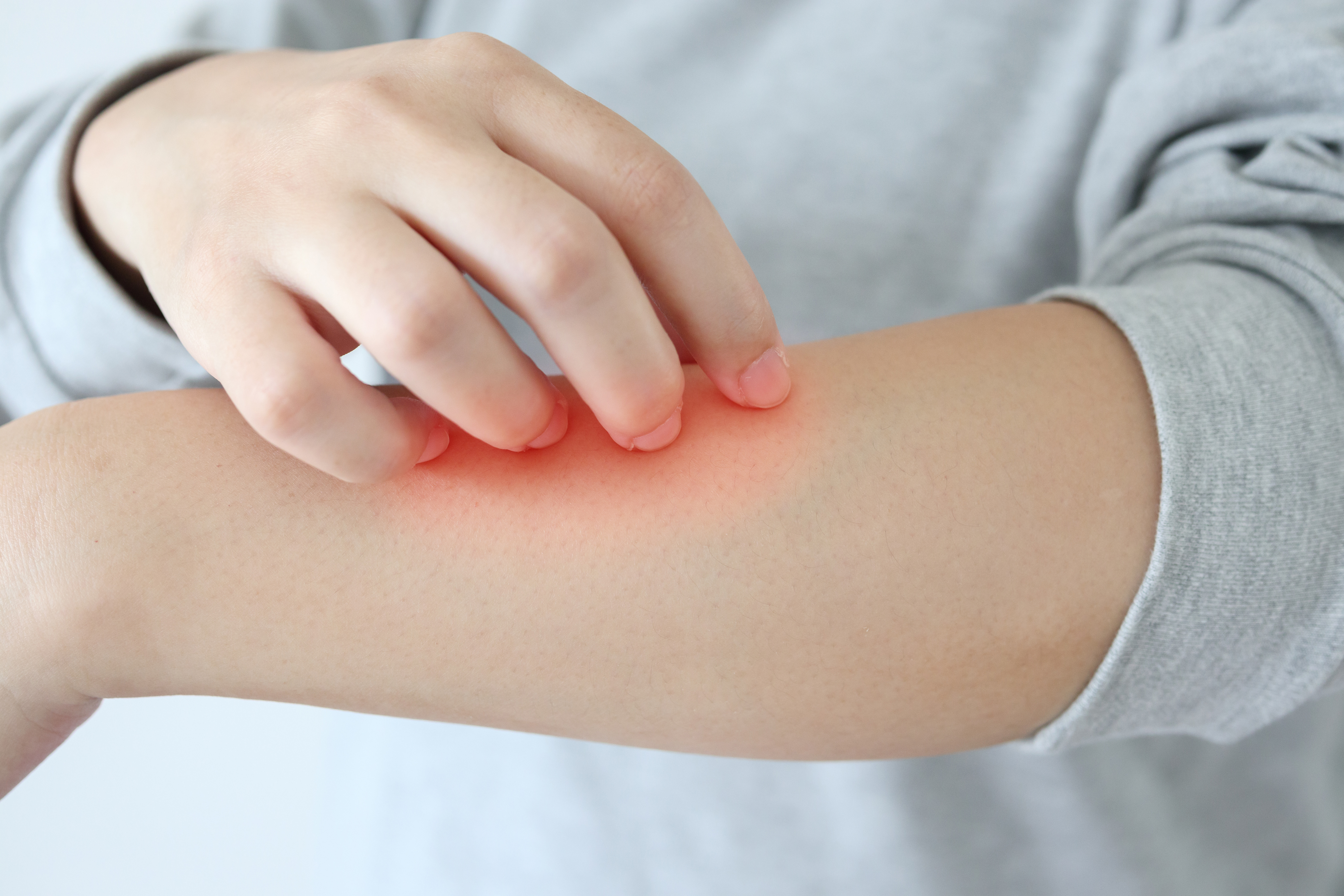 Choroby układu mięśniowo-szkieletowego w łuszczycy – dermatolodzy kontra reumatolodzy