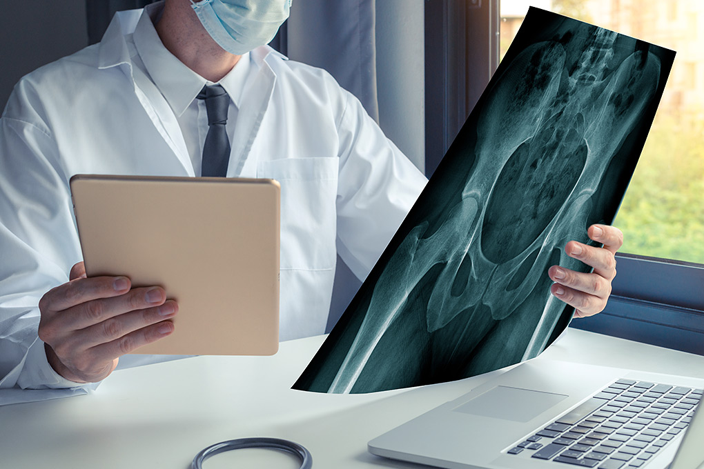 Procedura procedurze nierówna – rzecz o endoprotezoplastyce