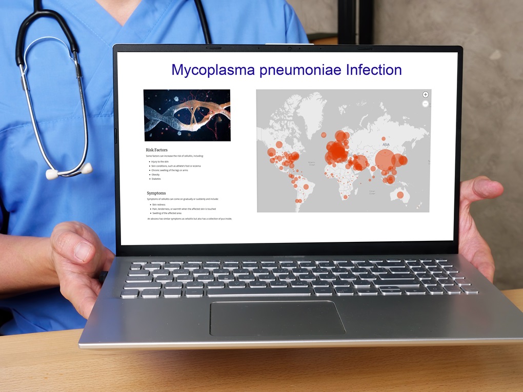 Mycoplasma pneumoniae główną przyczyną infekcji wśród dzieci
