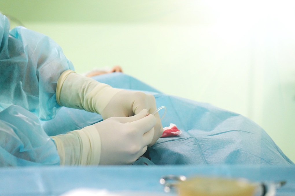 Zmiany w kryteriach ofert na opiekę ortodontyczną dzieci oraz żywienie w szpitalach
