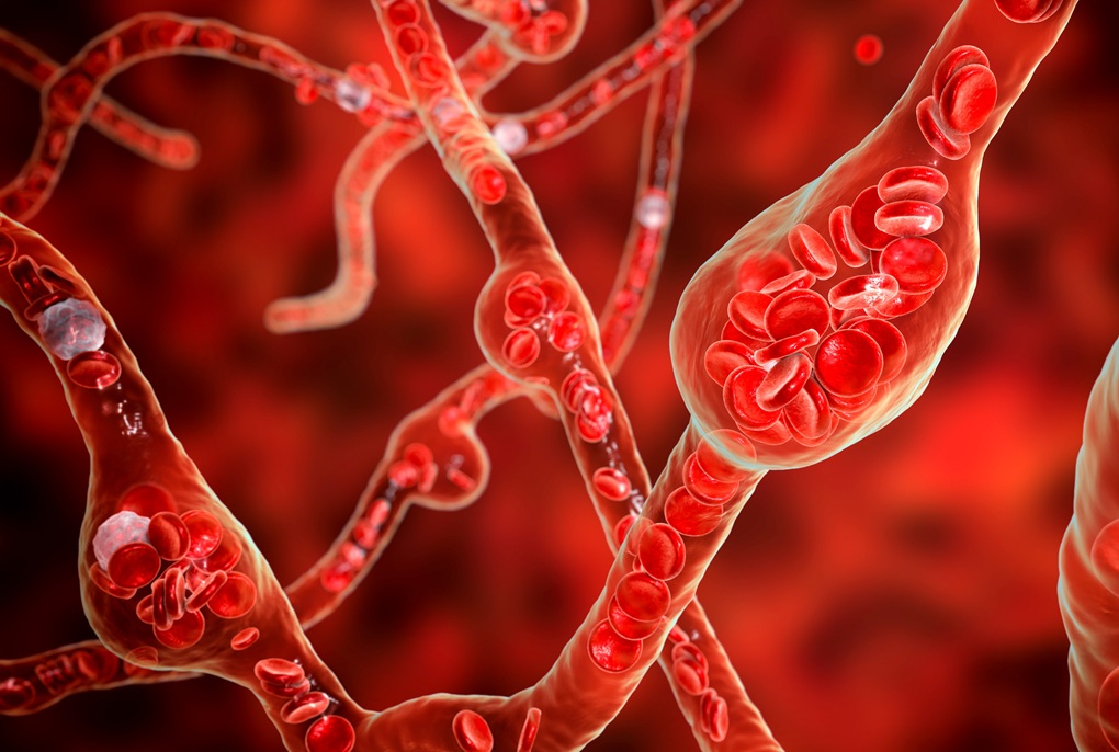 Szansa na zahamowanie wzrostu tętniaków aorty