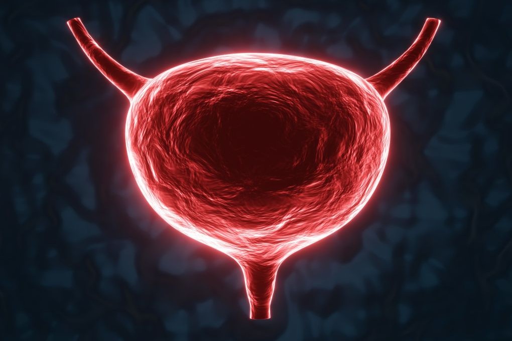 Nowa strategia poprawia ciągłość leczenia chorych na zaawansowanego raka urotelialnego