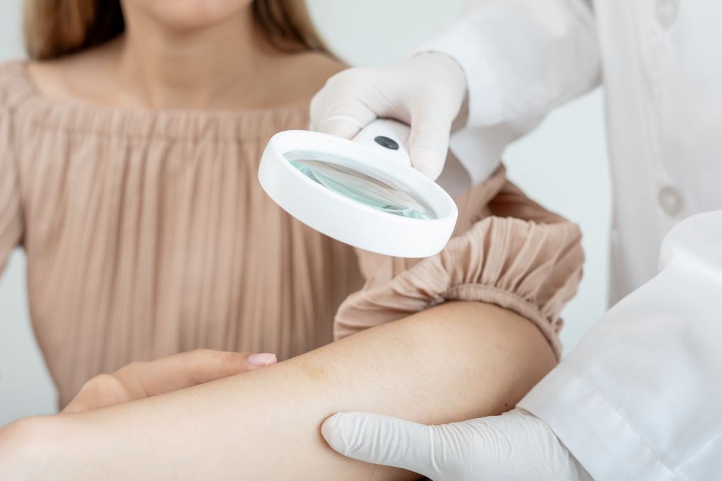 Solaria nie tylko zwiększają ryzyko raka, zmieniają też biologię skóry