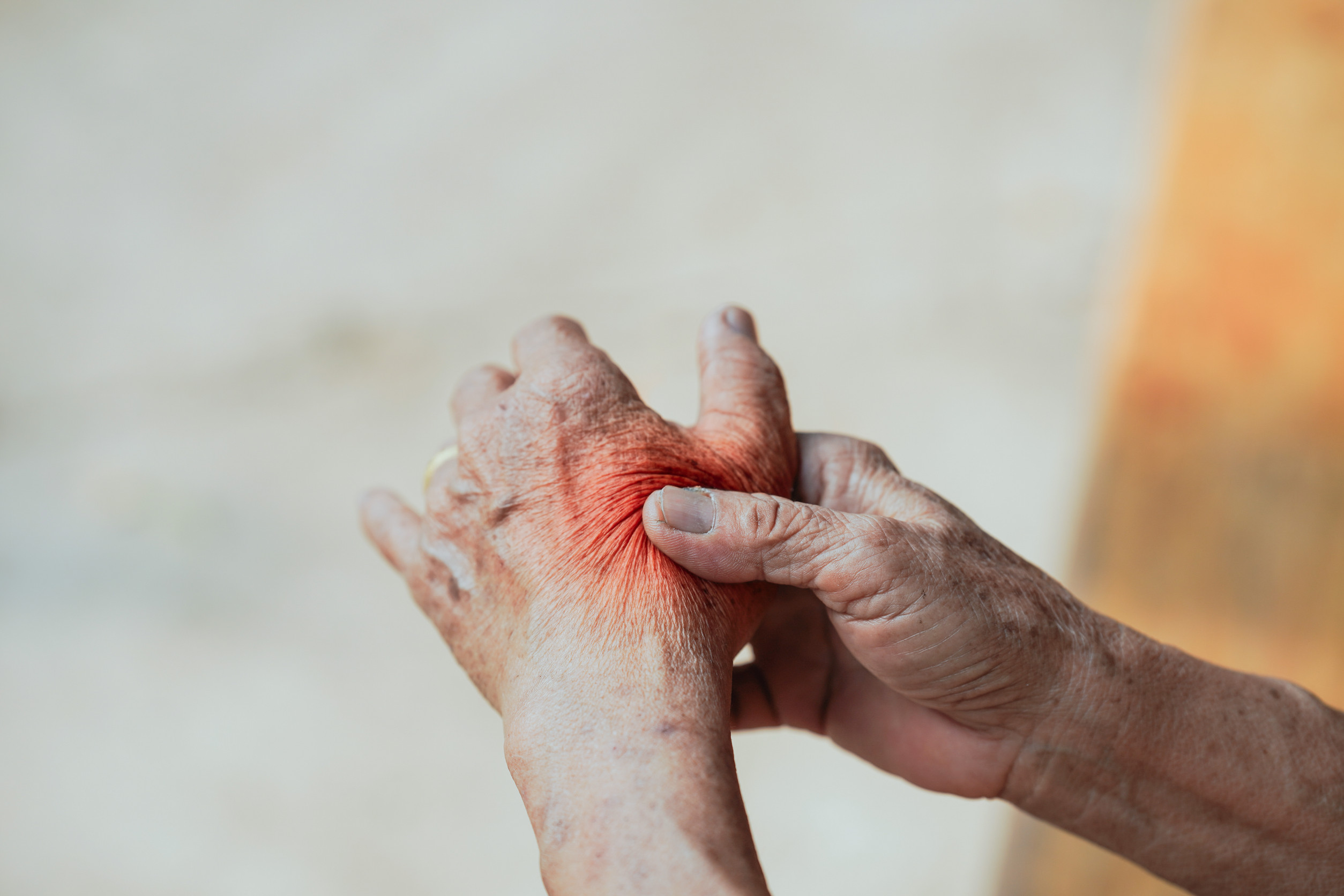 Alternatywa dla leków – stymulacja nerwu błędnego skuteczna w RZS