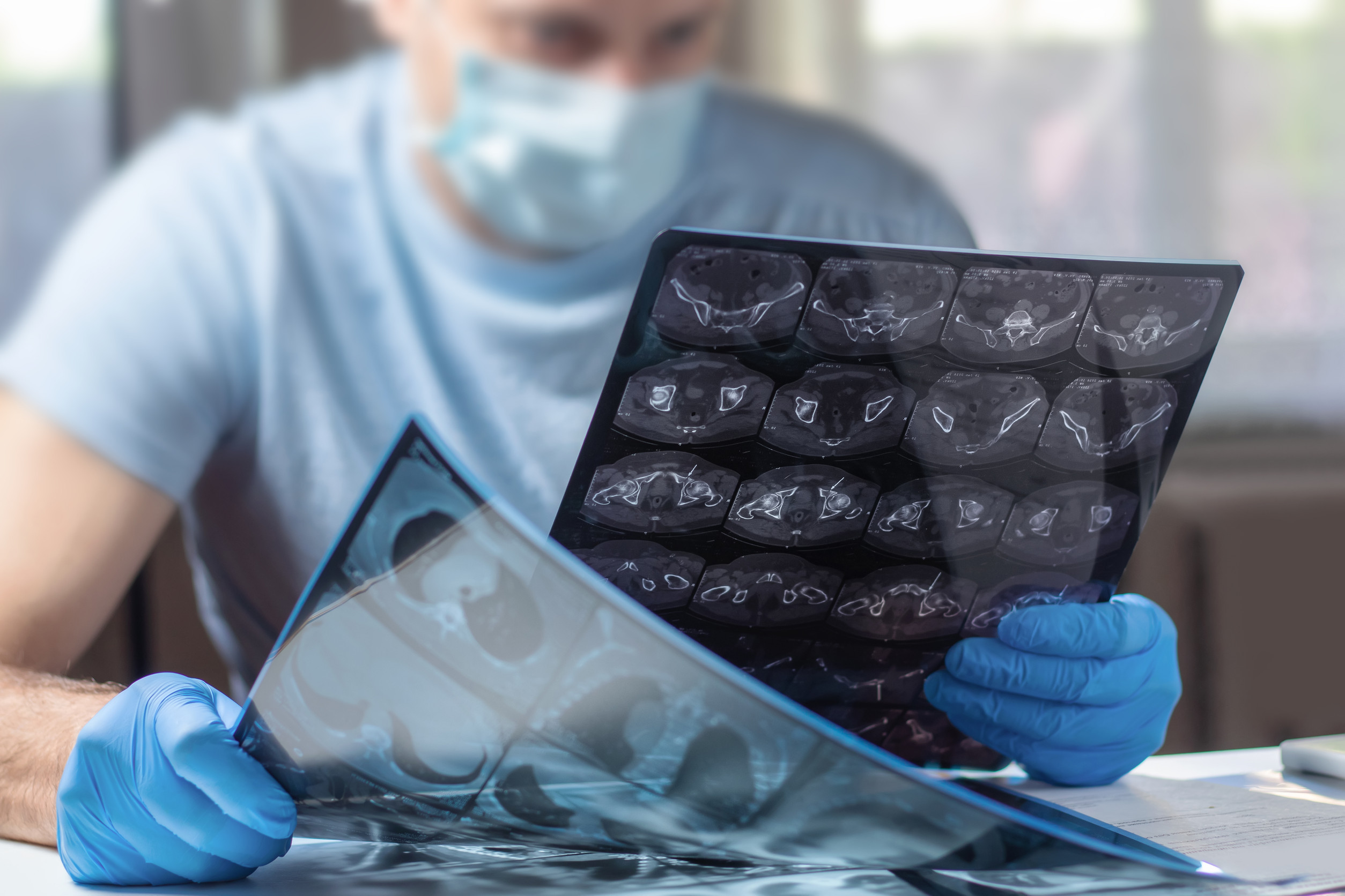 Znaczenie ctDNA w ocenie rokowania u chorych na chłoniaki