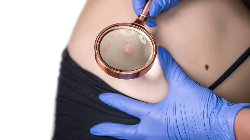 Pembrolizumab w leczeniu...