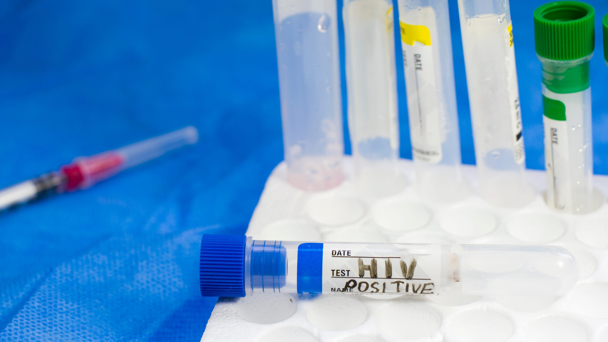 Rządowy projekt ws. finansowania leczenia HIV i HCV z poparciem Komisji ...