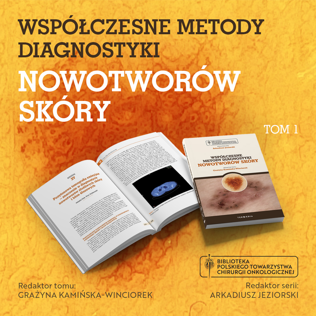 Wspólczesne Metody Diagnosytki Nowotworów Skóry
